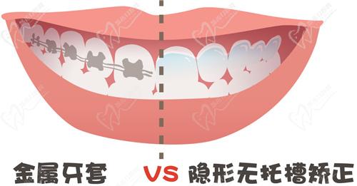 长沙牙大夫口腔矫正牙贵吗？