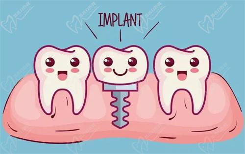 沈阳欢乐仁爱口腔种植牙技术靠谱