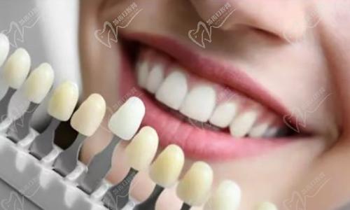 邯郸乐牙堡口腔全瓷牙
