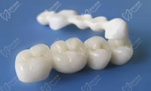 邯郸乐牙堡口腔全瓷牙