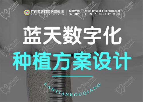 柳州蓝天口腔门诊数字化种植