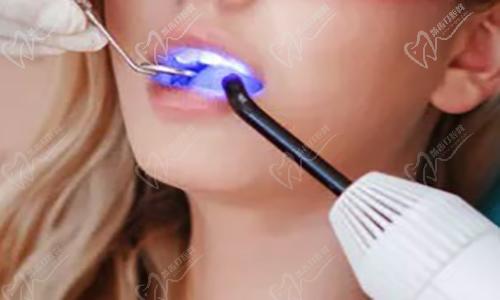 口腔正畸 口腔正畸