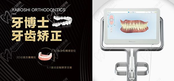 东莞大朗牙博士口腔3D数字化牙齿矫正技术