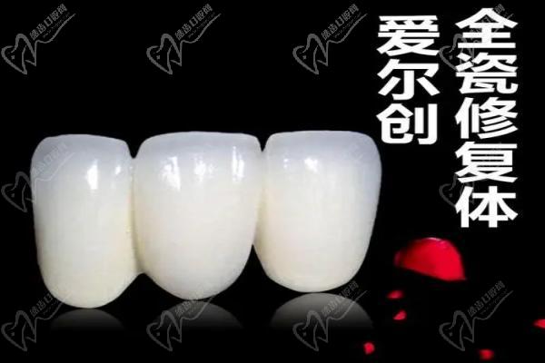 爱尔创全瓷牙贴面