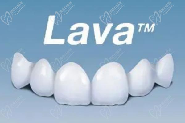 LAVA牙贴面