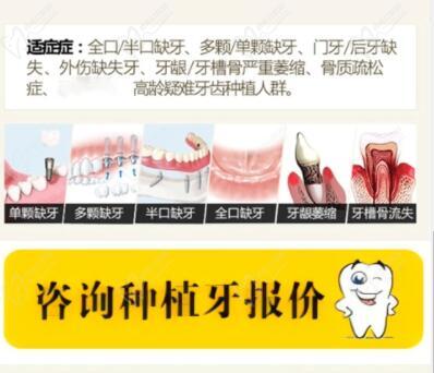 北京朝阳区附近正规牙科医院排名咨询种植牙报价