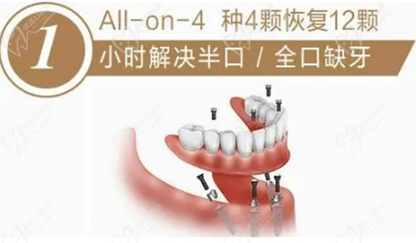 漳州冠成口腔