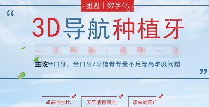 西安团圆口腔种植牙好不好