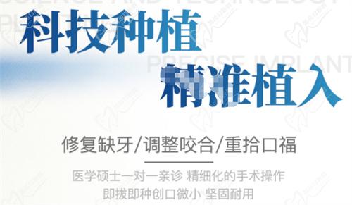 杭州雅莱口腔数字化美学种植 杭州雅莱口腔数字化美学种植