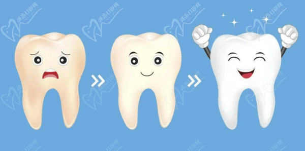 牙齿变白过程