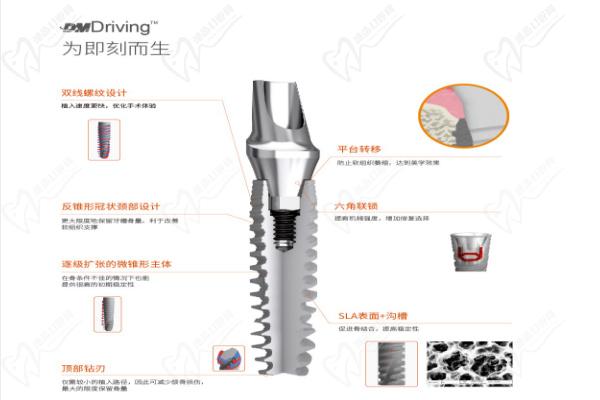 百齿泰DMDriving种植体