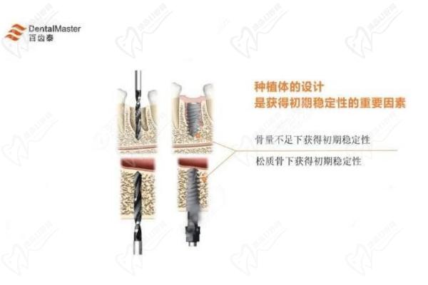 百齿泰种植有潜力