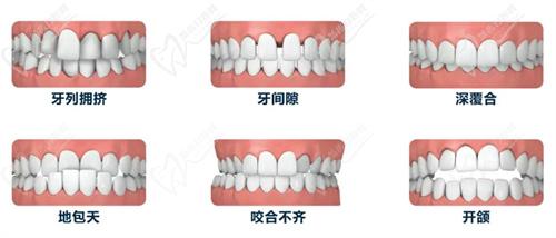 池州安美口腔牙齿矫正技术优势