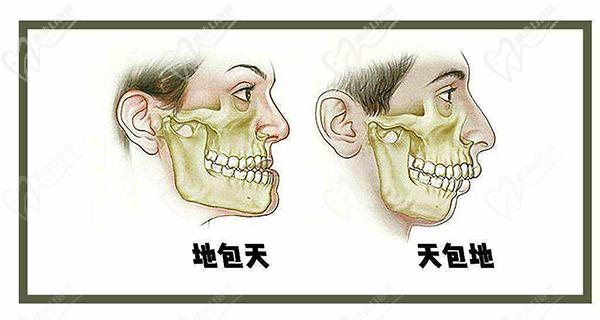 柳春明医生警示：如果孩子有了腺样体面容需要引起注意