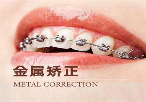 北京牙管家牙齿矫正图