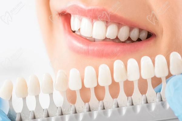 活性牙模美白对牙原色的掌握更灵活