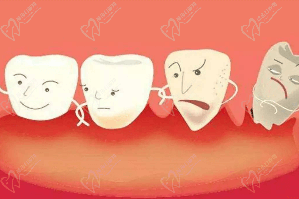 牙周炎牙龈萎缩牙齿松动怎么办