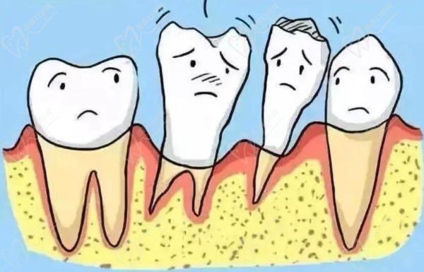 重度牙周炎能治好吗？