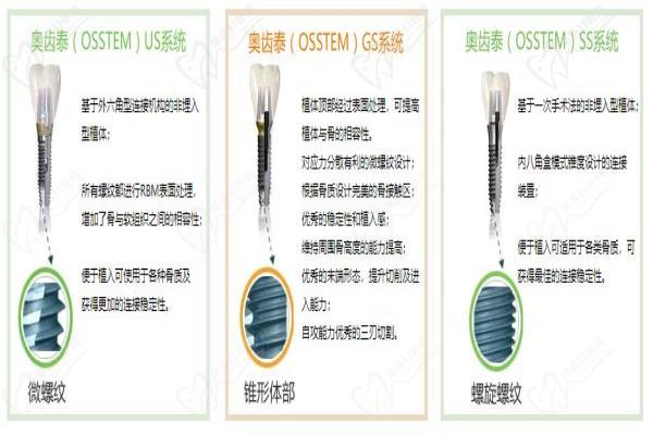 韩国奥齿泰种植牙不同型号