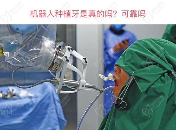 请问机器人种牙普及了吗？机器人种植牙是真的吗？可靠吗