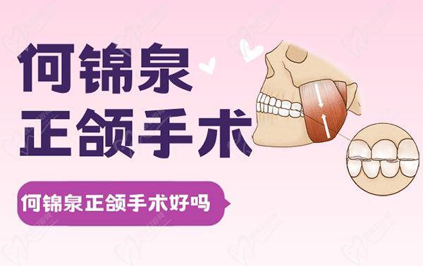 有何锦泉正颌手术亲历者吗？能告诉亲我何锦泉做正颌怎么样