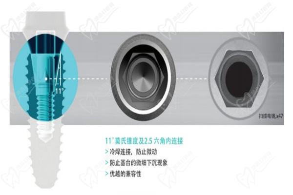 韩国柯威尔种植体表面