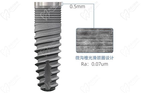 德国sky种植体使用寿命是几年