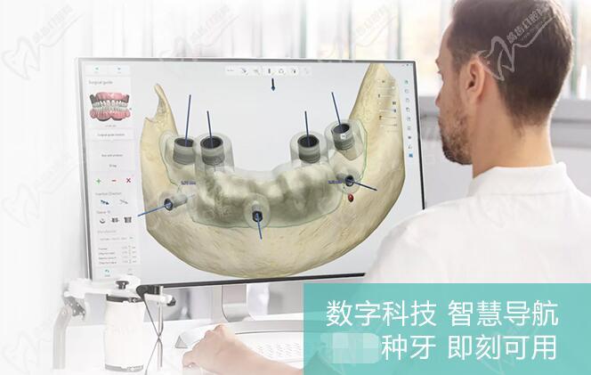 深圳麦芽口腔医院种牙价格收费标准