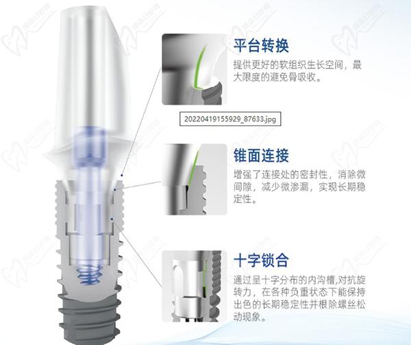 康盛种植牙型号