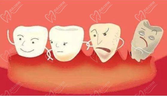 牙龈炎导致牙缝变大还可以恢复吗?