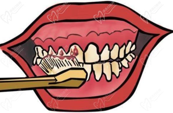 牙龈炎导致牙缝变大还可以恢复吗?