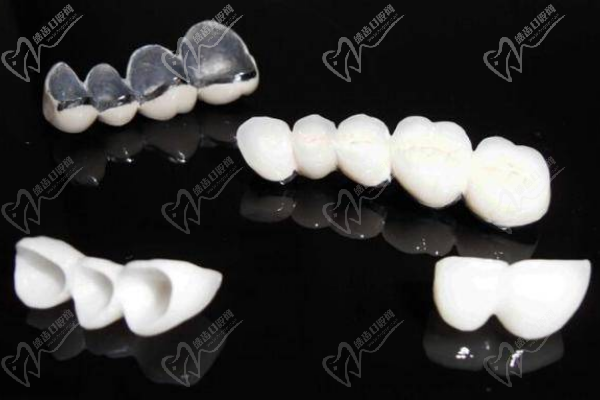 进口全瓷牙冠品牌及价格表