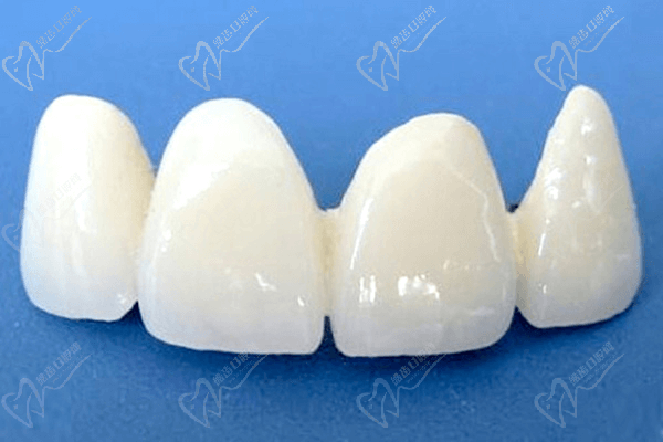 进口全瓷牙冠品牌及价格表