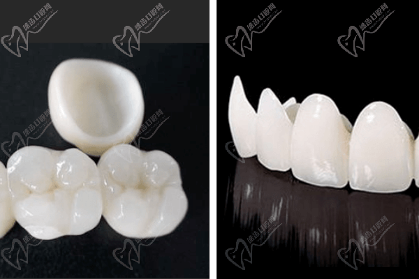 进口全瓷牙冠品牌及价格表