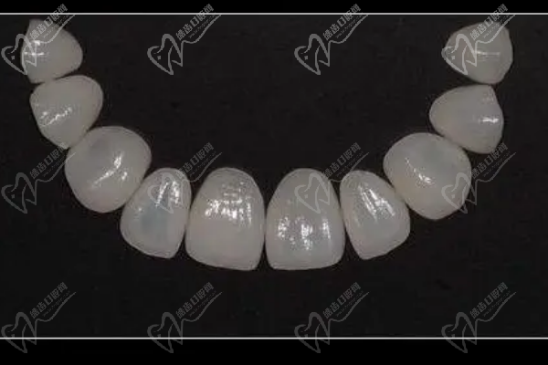 进口全瓷牙冠品牌及价格表