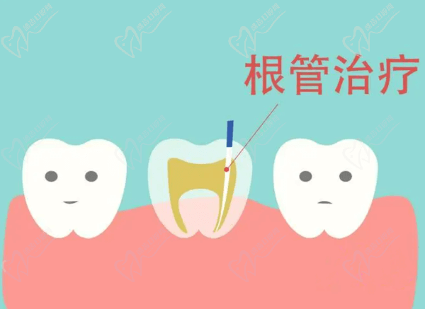 牙齿治疗