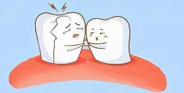 牙断了半截修复多少钱
