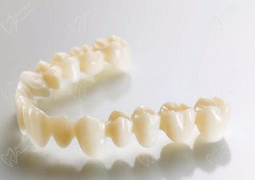 树脂牙冠图片 树脂牙冠图片