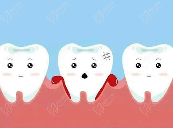 牙龈萎缩的早期三大症状