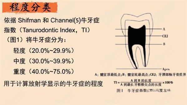 牛牙症