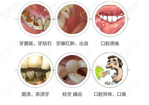 定期洗牙有必要吗