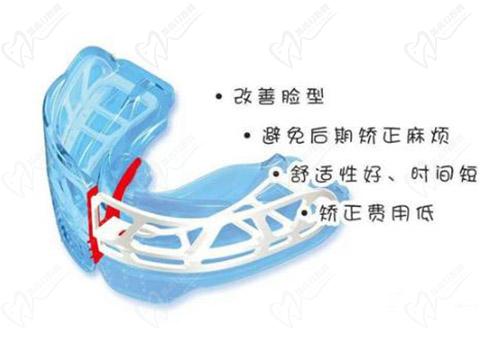 儿童mrc矫正器疗效好吗