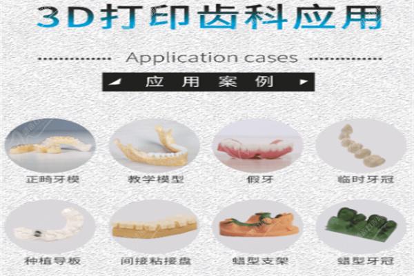 椅旁数字化修复3D打印技术