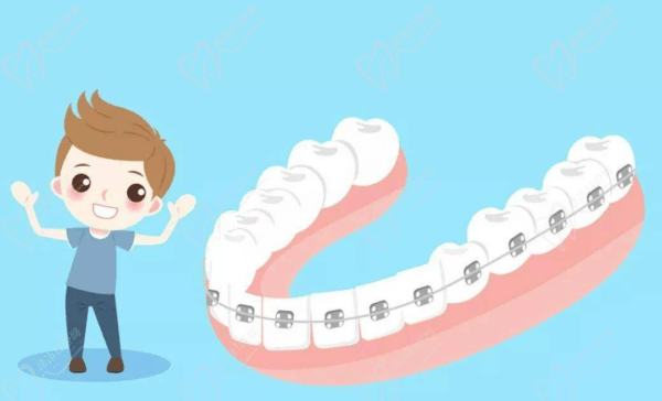 牙齿问题