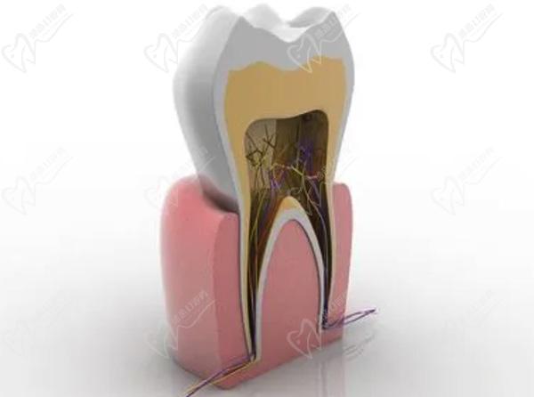 牙齿杀神经和根管治疗的区别哪个好一点