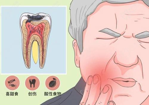 牙髓炎一跳一跳是怎么回事