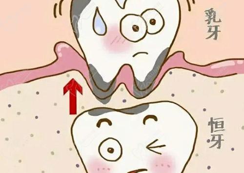 乳牙牙根露出怎么解决