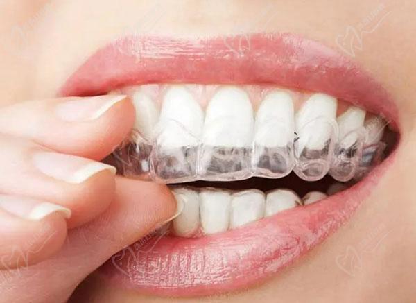 过了多少岁不建议牙齿矫正？
