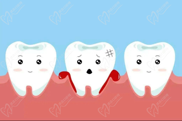 牙龈有点肿是什么原因引起的？