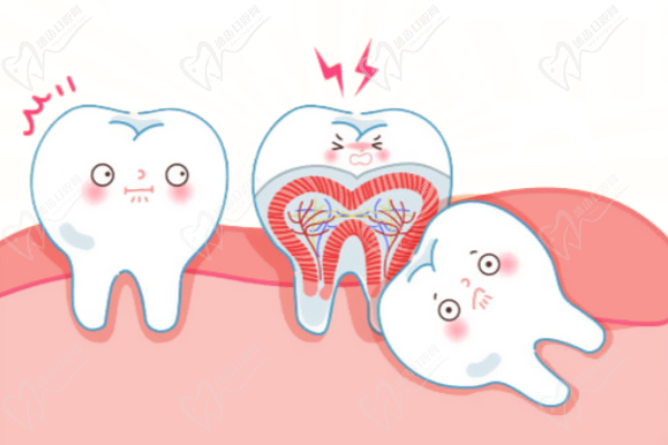 牙龈有点肿是什么原因引起的？